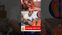 ಪಾದಗಳಲ್ಲಿ ಉರಿ ಇದೆಯಾ? #HealthTips #BurningFeet #DiabetesCare