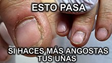 Ella sola se lastimó las uñas