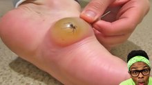 ¿Por qué lo explotaron?