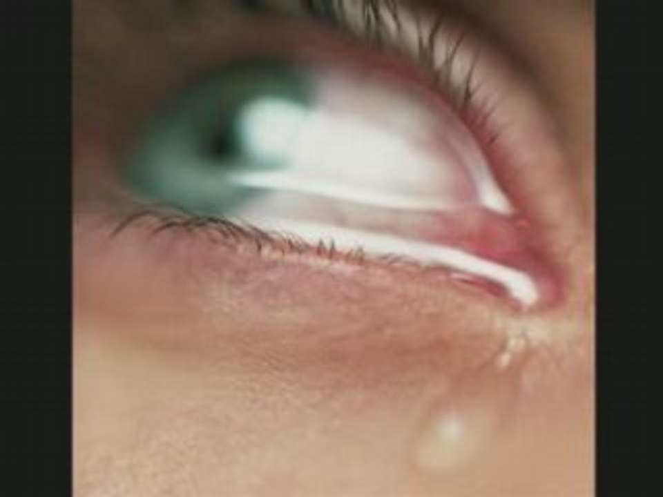 2º Capitulo