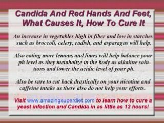 Candida And Red Hands And Feet, What Causes It, How To Cure