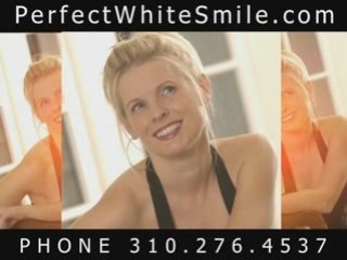 Beverly Hills Porcelain Veneers Dentist