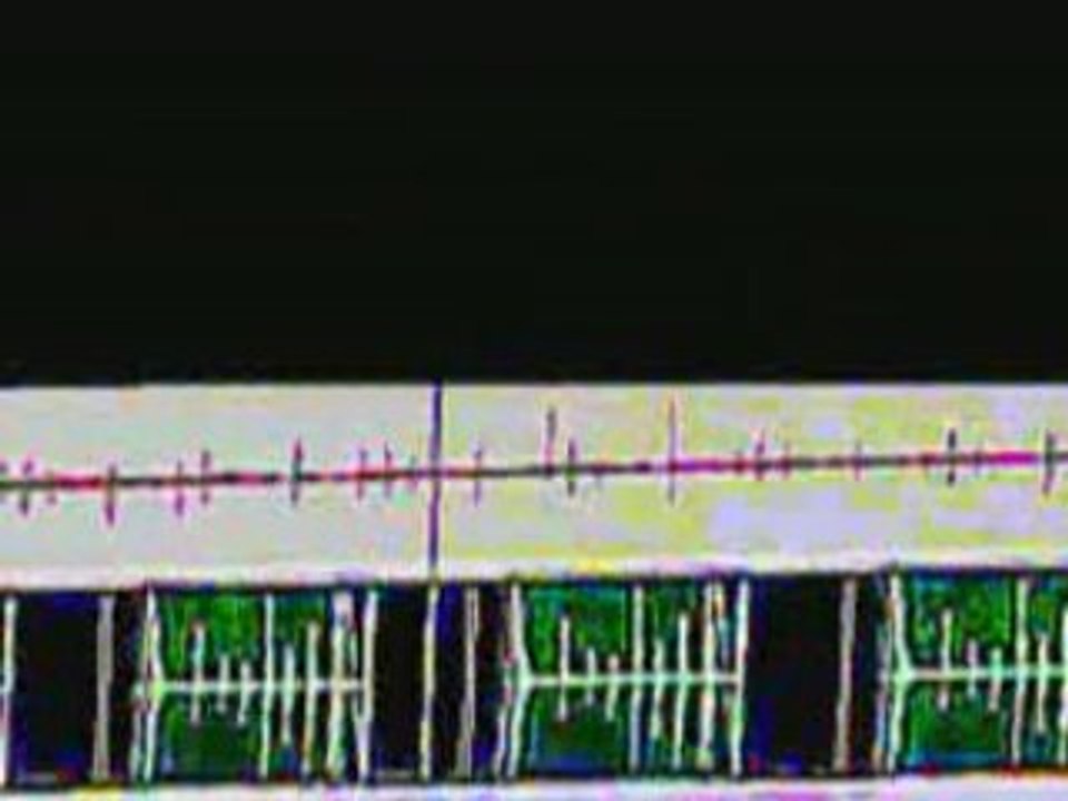 ZUMABREK _ CLOCK FEVER