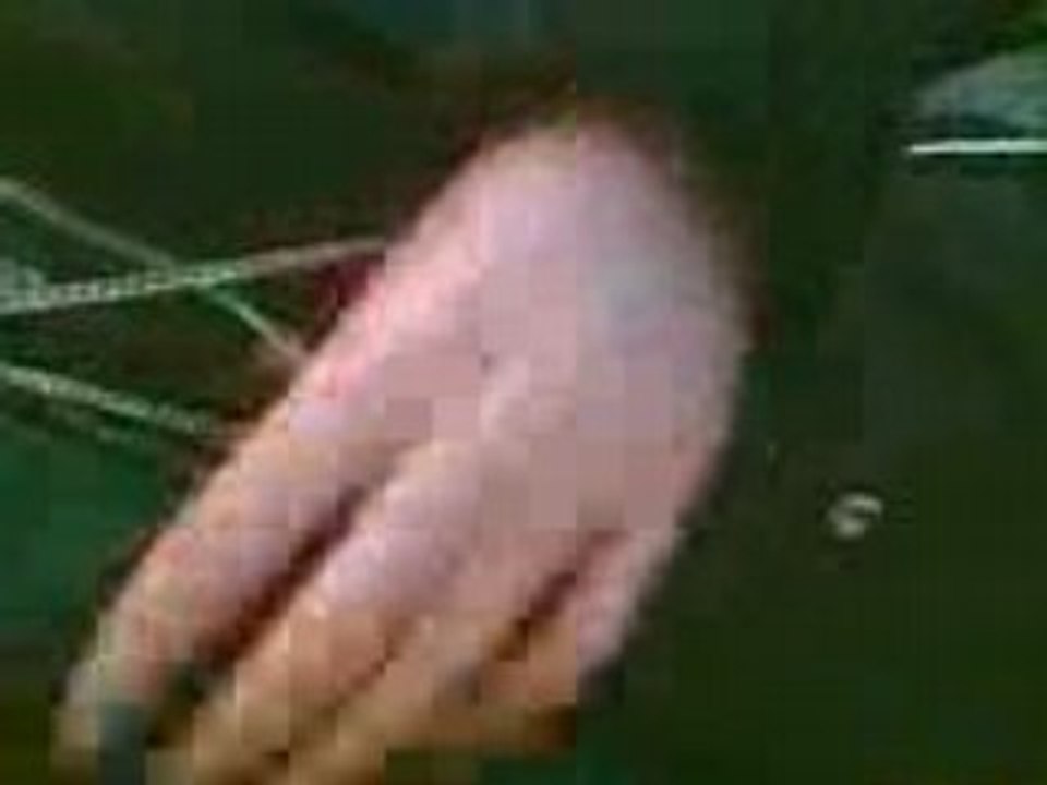 Video000