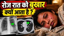 Roj Rat Ko Bukhar Aana: रोज रात को बुखार आना किस बीमारी का लक्षण,बार बार आने पर क्या करें ?
