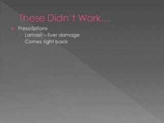 Toe Nail Fungus Solution