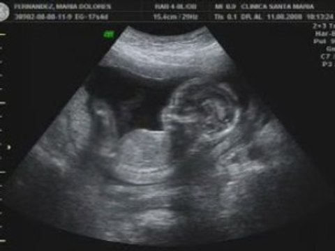 Ecografia-20080811