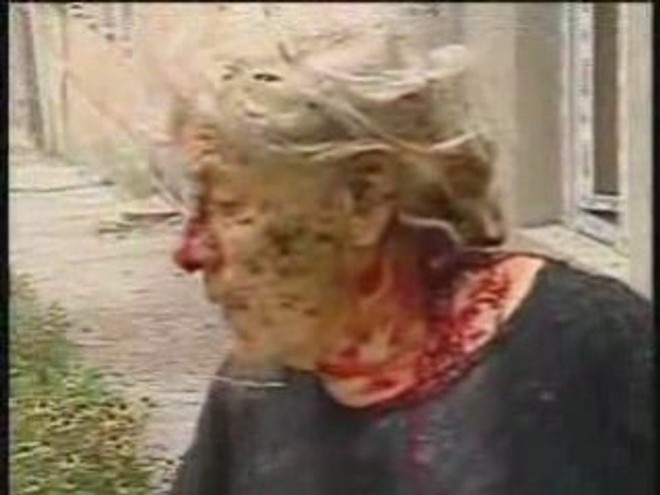 Russian War Crimes in Georgia Part 2