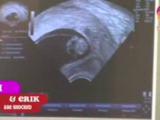 Week 9 - first ultrasound