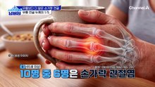 무릎보다 더 얇은 손가락 연골! 10명 중 6명이 손가락 관절염을 앓는다?