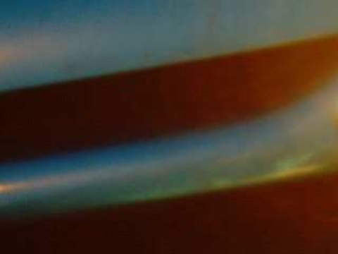 Bruit kit admission 206