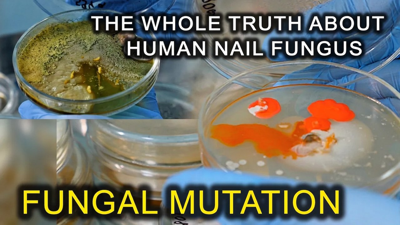 THE TRUTH ABOUT FUNGI | WHY FUNGI MUTATE | HOW TO TREAT NAIL FUNGUS ...
