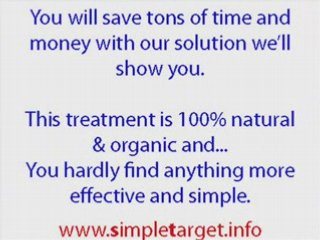 Remove genital warts at home