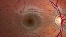 AI Predicts Heart Attack From Eyes