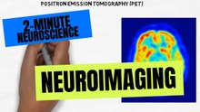 2-Minute Neuroscience: Neuroimaging Explained | CAT, MRI, PET & fMRI Brain Imaging Basics