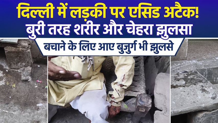 भजनपुरा में 24 साल की लड़की पर एसिड अटैक, बचाने वाले बुजुर्ग भी झुलसे