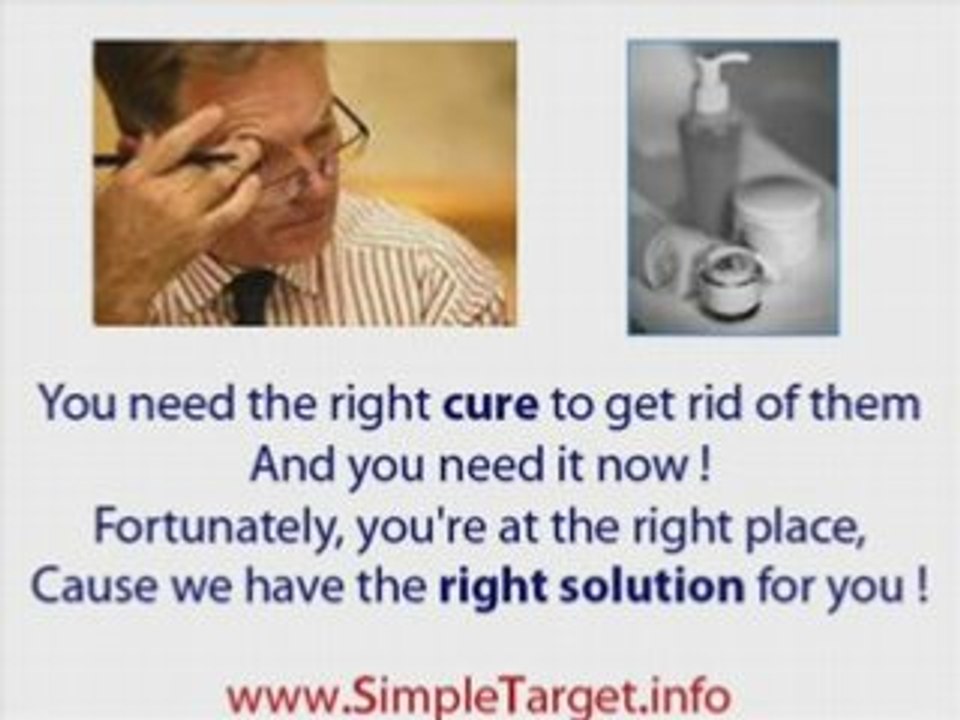 Natural genital warts treatment