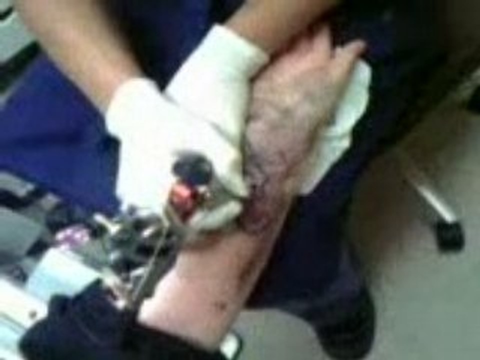 Tatuering