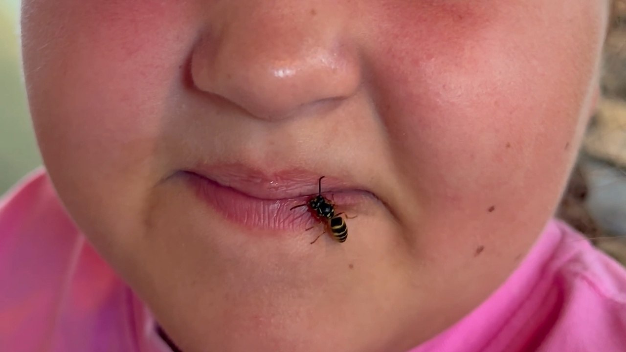 Insect Walks on a Little Girl's Mouth - video Dailymotion