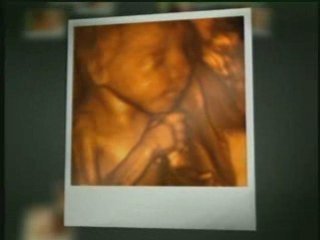 Prenatal Impressions Pregnancy Spa & 3D/4D Ultrasound Center