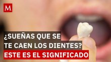 ¿Es algo malo? Este es el significado de soñar que se te caen los dientes