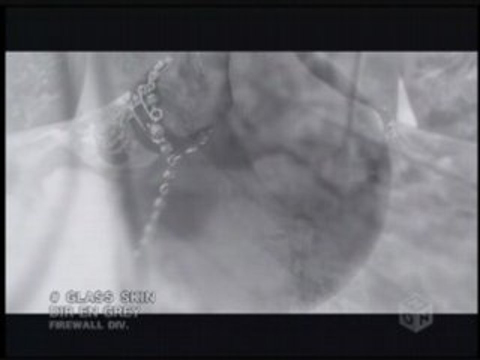 Dir en Grey - Glass Skin