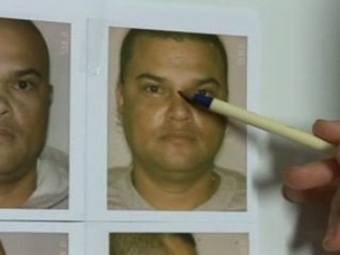 Beverly Hills Rhinoplasty Surgeon