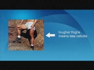 Anti Cellulite Treatment