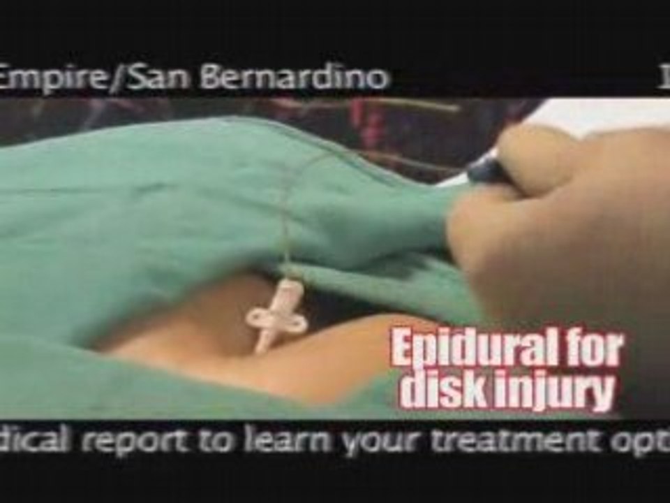 Best job related injury pain doctor Southern California