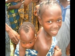 Dent d'ivoire et peau d'ébène