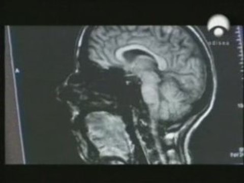 Memoria emocional: Diferencias de genero