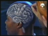 Anatomia del cerebro