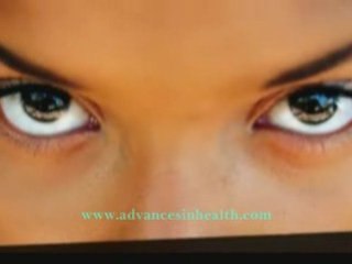 Sotretinoin treatment for cystic acne