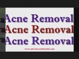 Get rid of acne scars and blemishes