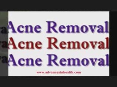 Get rid of acne scars and blemishes