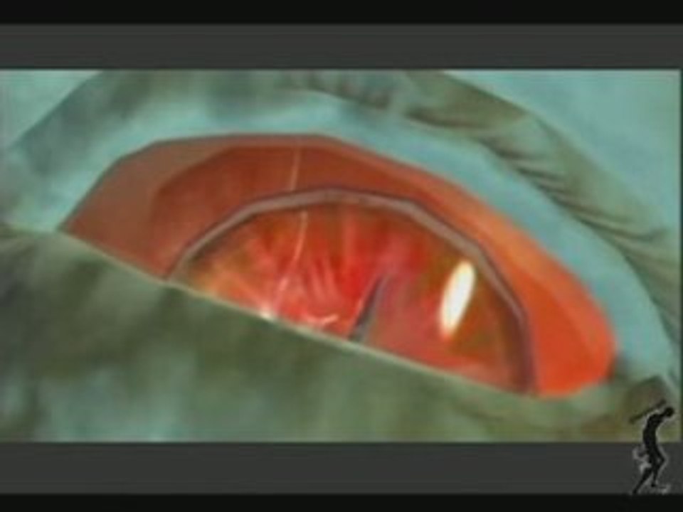 Resident Evil : Code Veronica X - Steves Fate