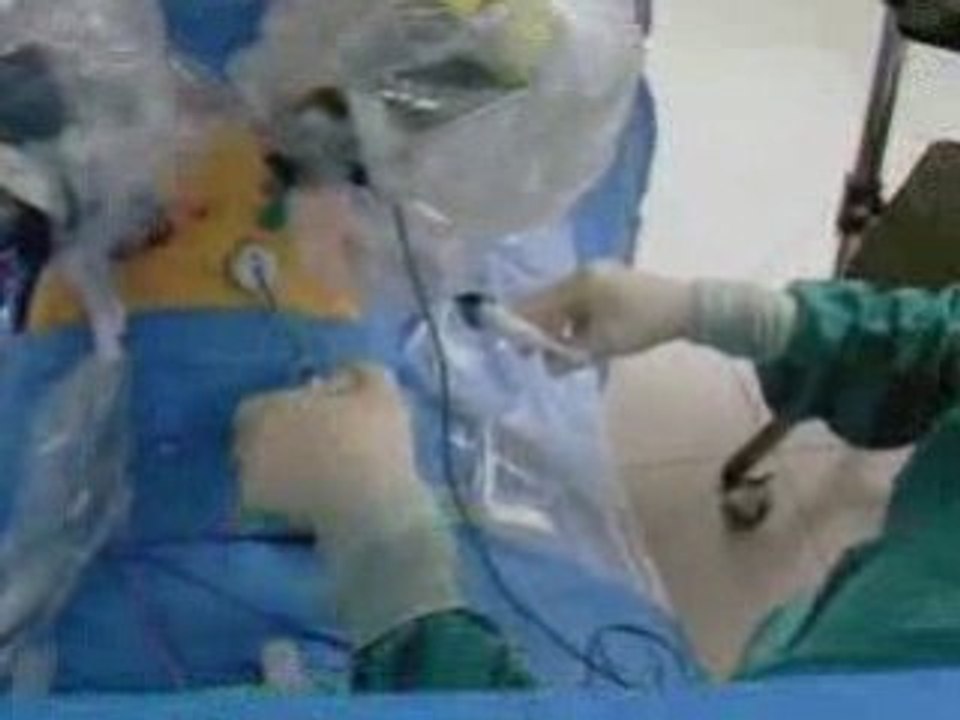 da Vinci Robotic-Assisted Prostate Surgery