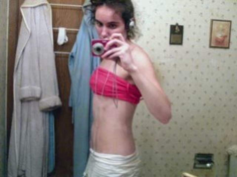 Anorexia: My Nightmare Keeps Going