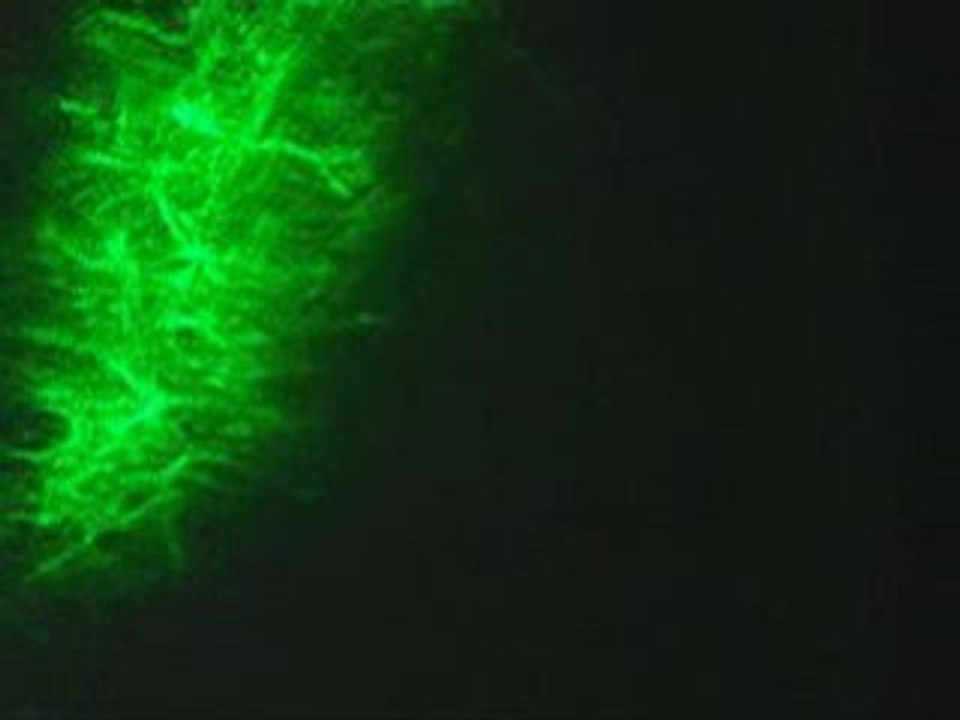 Laser