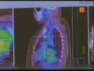 PET-TAC (Tecnologia de vanguardia)