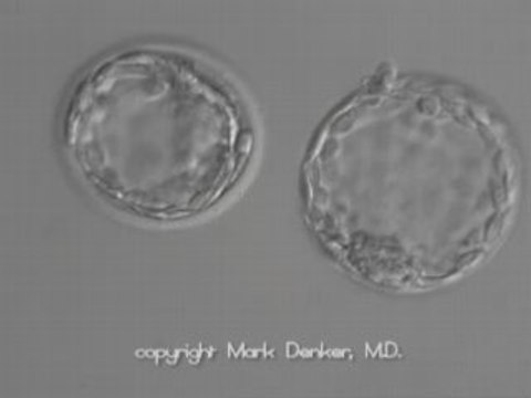 Florida Fertility Treatment - IVF & ICSI