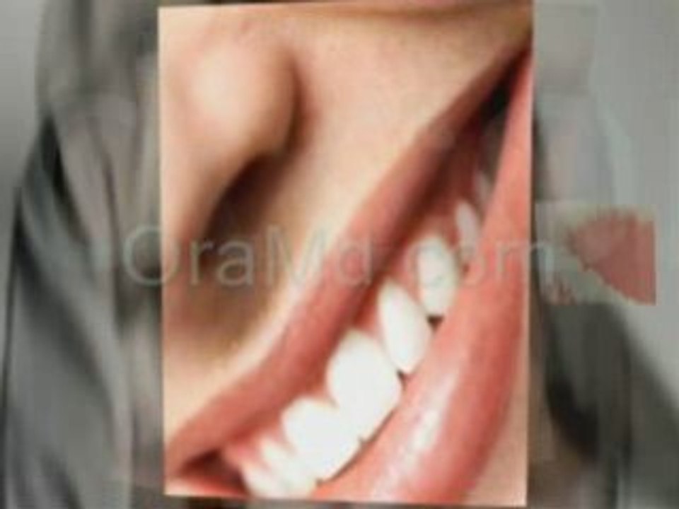 How To Repair Receding Gums Naturally
