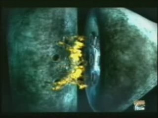 Adicciones y dopamina