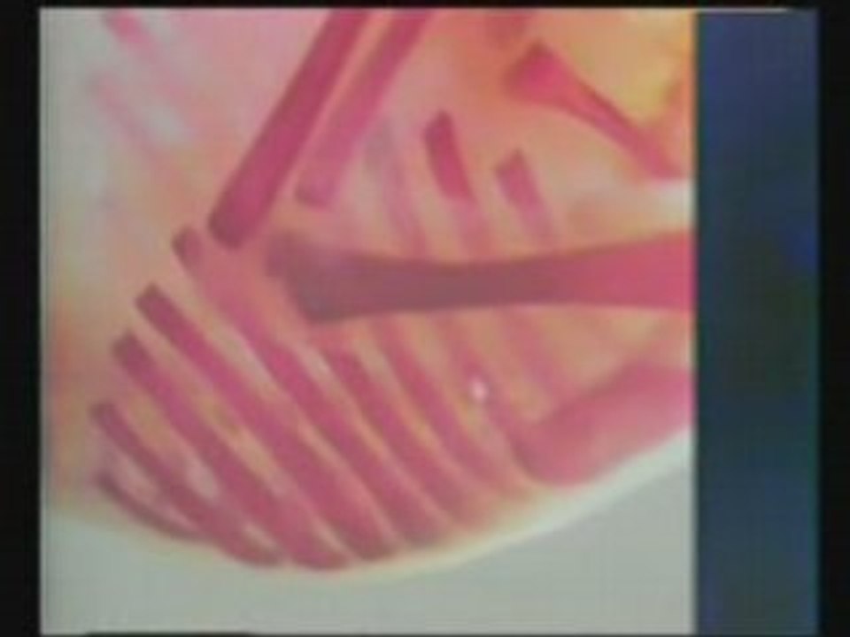 THE WRAPPING OF MUSCLES OVER THE BONES &Miracles of Quran