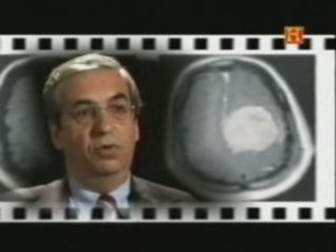 Egas Moniz: Lobotomia