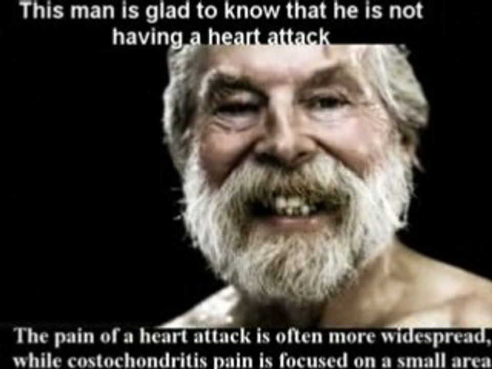 Costochondritis by Farshchian