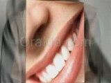 Receding Gums And Periodontal Disease A Very Sensitive Topic