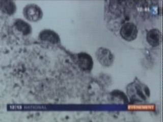 Télézapping : Cocorico Nobel