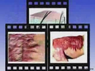 الإعجاز القرآني - مراكز الألم