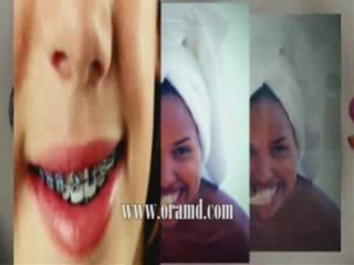 Existing damage of receding gums and solutions